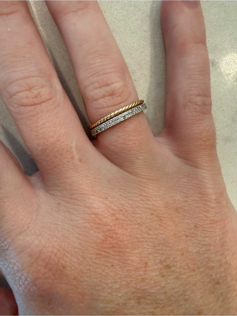 Ring Concierge Rings - Picture 2 of 5